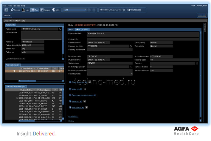 Текстовая область на рабочем столе отдела диагностики IMPAX Agility