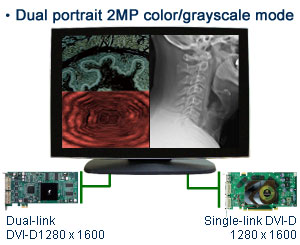 Монитор PACSmate MMD-400C, отображающий сигнал с двух видеокарт (цветной / оттенки серого)